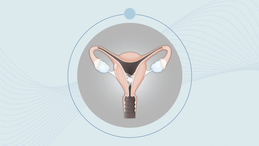 Asherman-szindróma borítókép