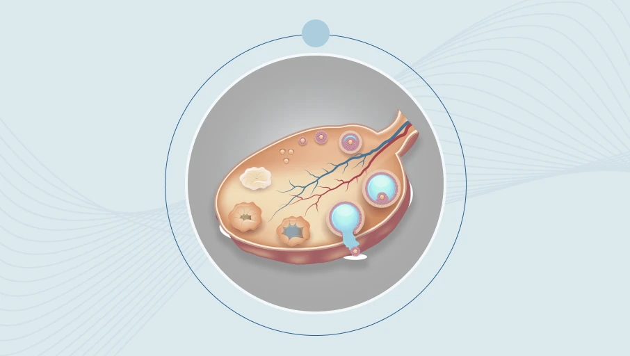 Mi a tüsző? Borítókép